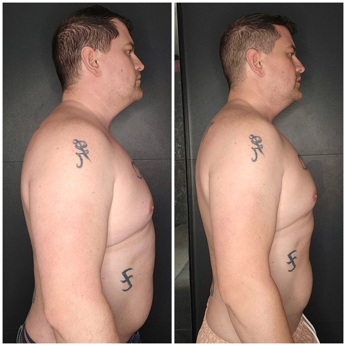 Phil side before and after progress photo